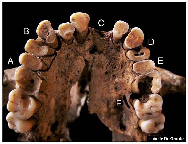 Teeth