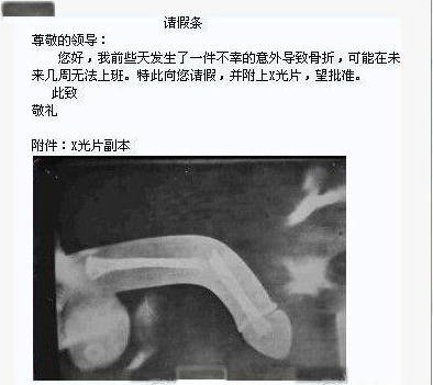 JJ斷了