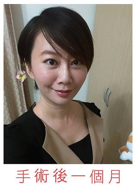 手術後一個月