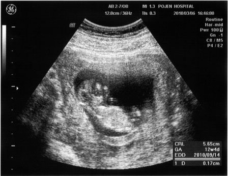 0306-baby.jpg