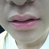 A酸10.jpg