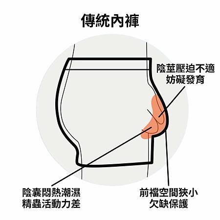 穿上好內褲，健康跟著走－男性內褲選購指南