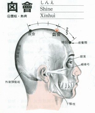 顖會穴.jpg