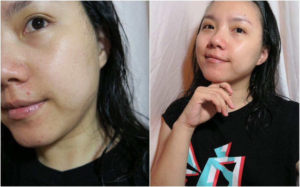 loveisderma8.jpg