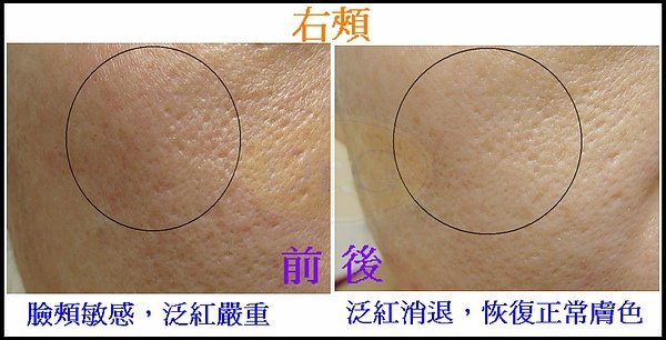 右頰合併1.jpg