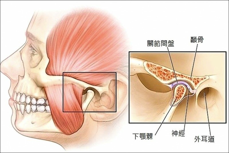 顳顎關節障礙症.jpg