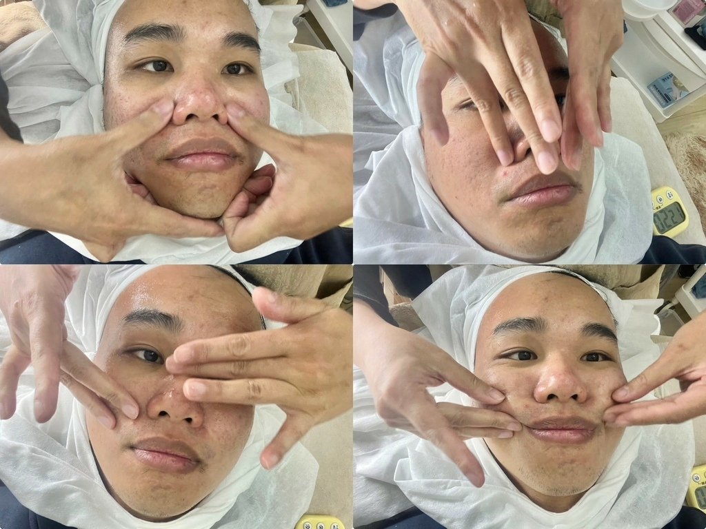 （台北做臉推薦）PURE Essense Skin Mana
