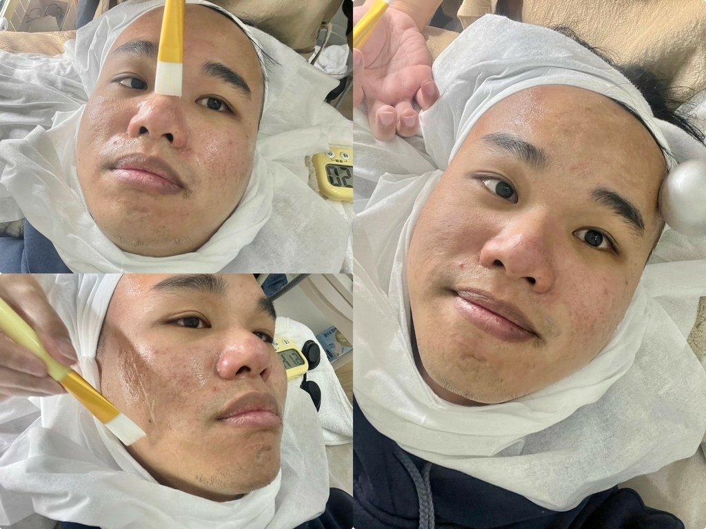 （台北做臉推薦）PURE Essense Skin Mana