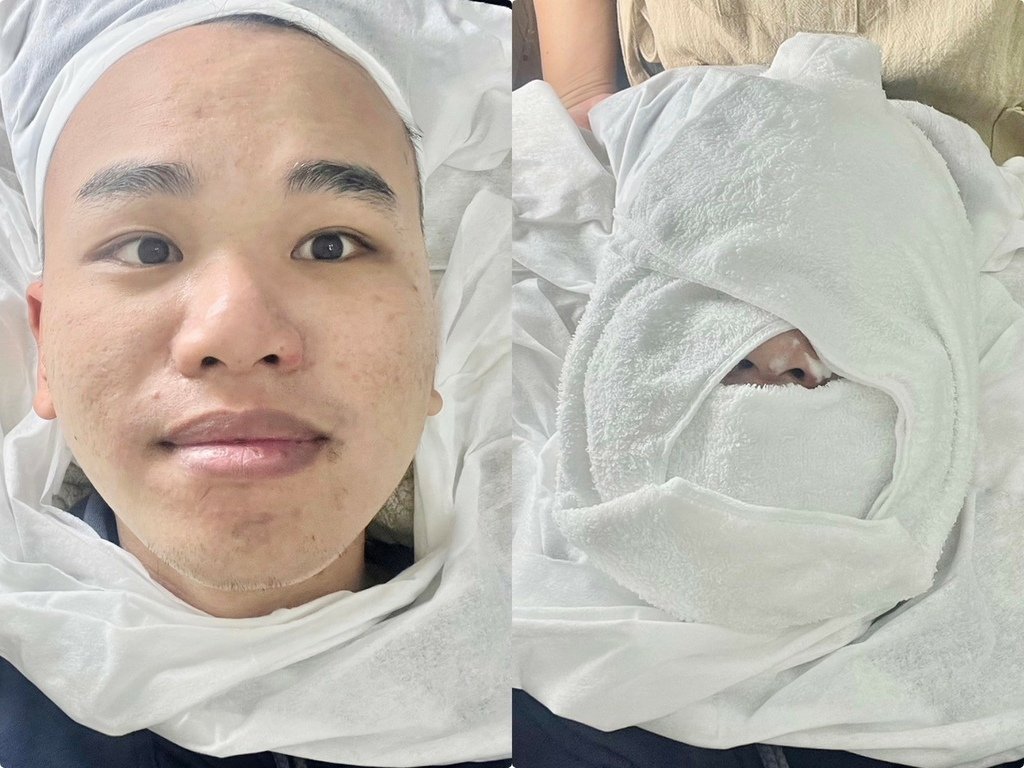 （台北做臉推薦）PURE Essense Skin Mana