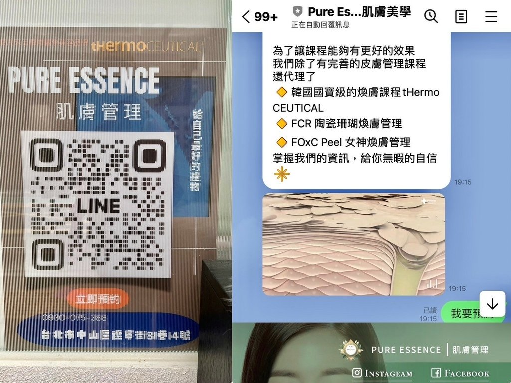 （台北做臉推薦）PURE Essense Skin Mana