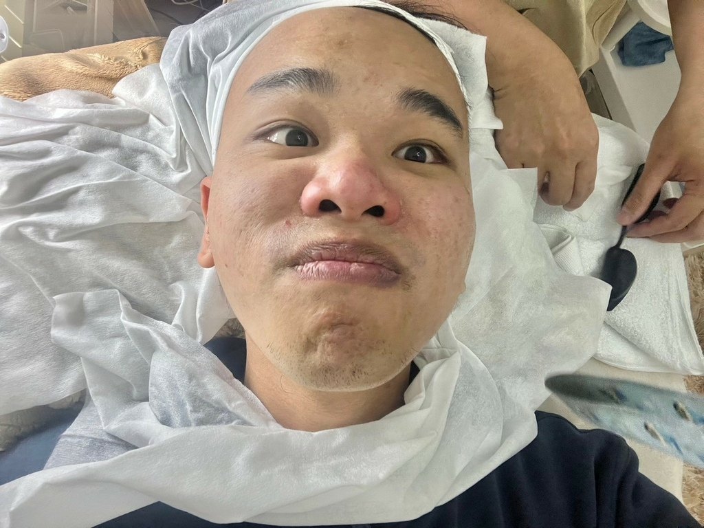 （台北做臉推薦）PURE Essense Skin Mana