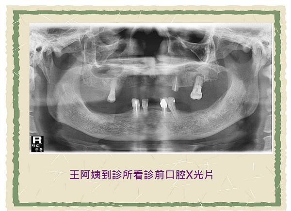 王阿姨.1