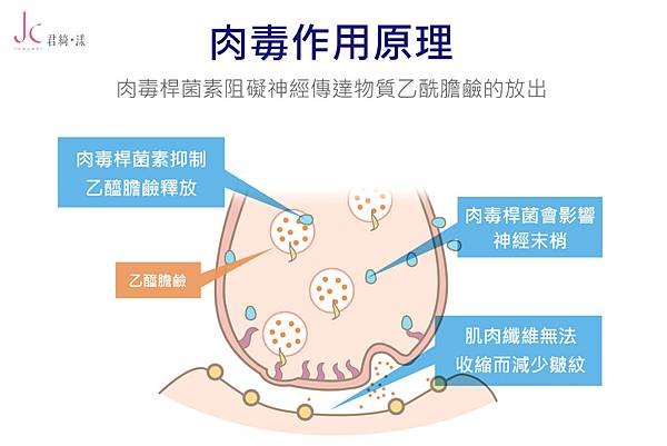 肉毒小教室_肉毒原理.jpg