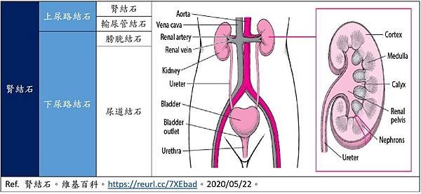 Urolithiasis2.jpg