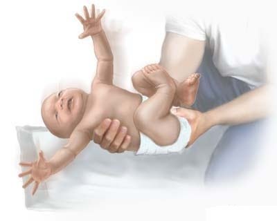 Moro reflex.jpg