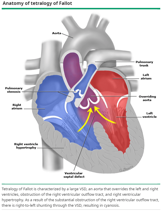 TOF anatomy.png