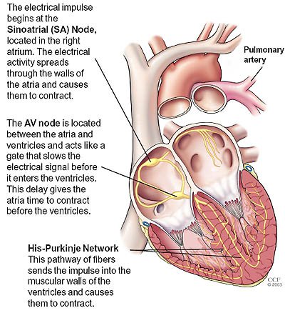 cardiac arrhythmia