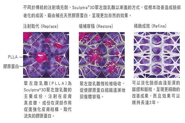 童顏針3.jpg