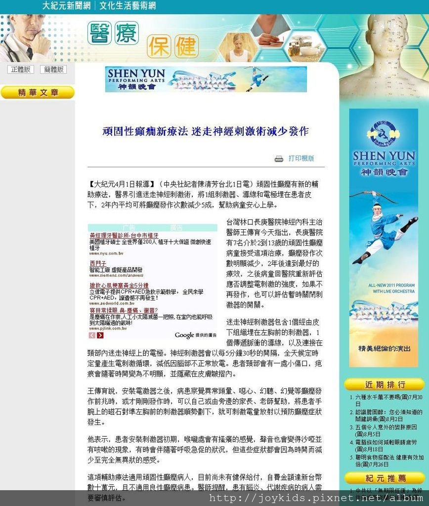 頑固性癲癇新療法 迷走神經刺激術減少發作.jpg
