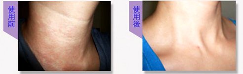 使用前使用後.jpg