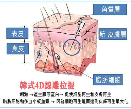 台中拉皮｜4D線雕提拉10.jpg