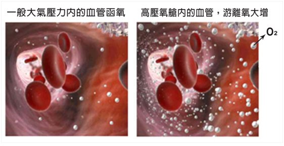 高壓氧護理-3.jpg