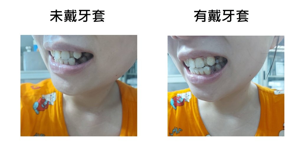右臉.jpg
