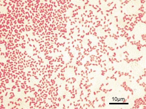 Pseudomonas_aeruginosa_Gram