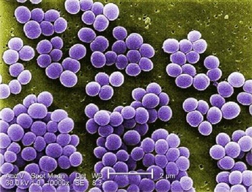 coccus-281774-400-305