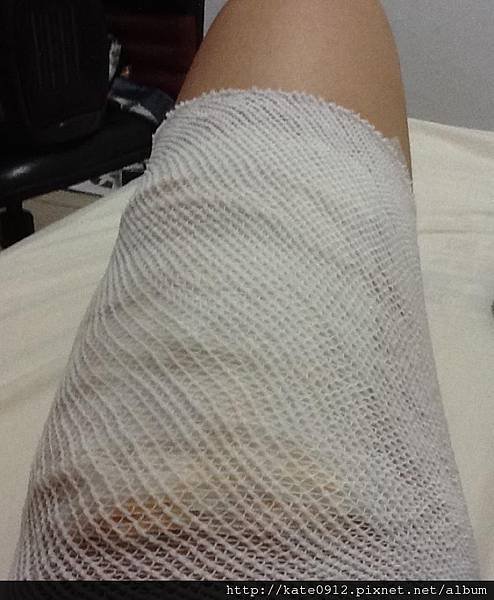HURT3.jpg