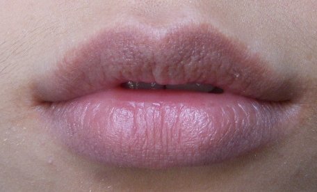 bitelips (12).JPG