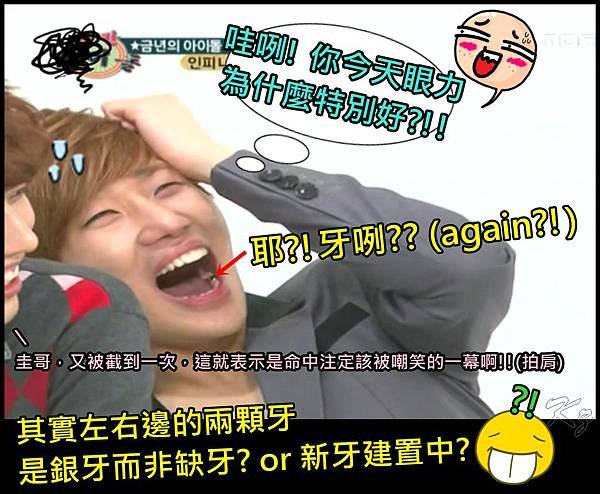 weekly idol-sg&apos;s teeth again.jpg