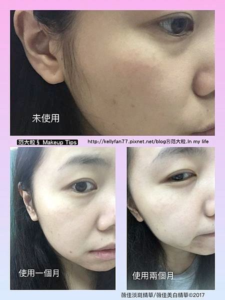 薇佳淡斑精華03.jpg