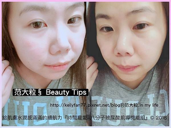 時間寵愛-八分子玻尿酸前導機能組06.jpg