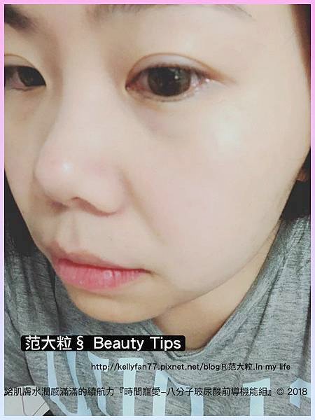 時間寵愛-八分子玻尿酸前導機能組09.jpg