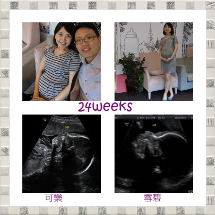 超音波24weeks