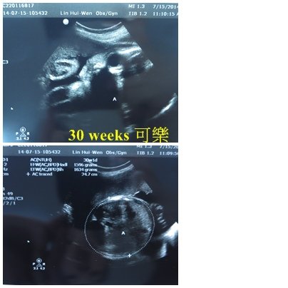 02-30weeks可樂