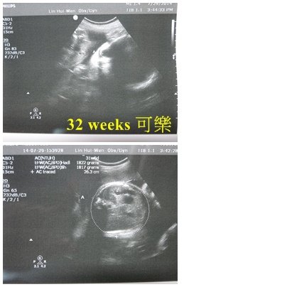 04-32weeks可樂