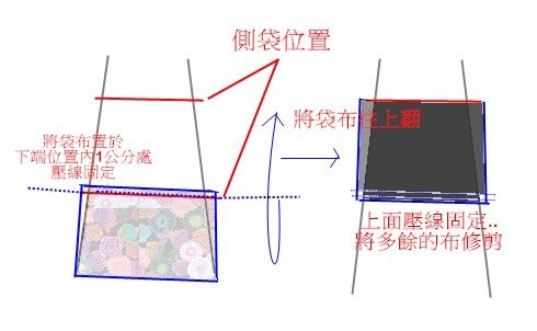 側袋縫法