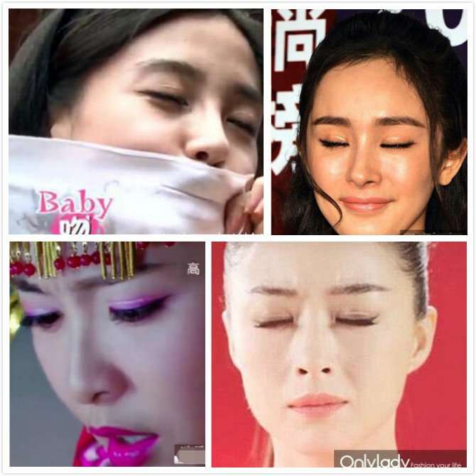 凱蒂醫美診所縫雙眼皮割雙眼皮台北推薦醫師 (4)