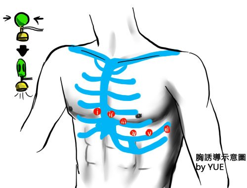 EKG2 胸誘導示意圖.jpg