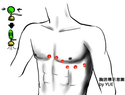 EKG2 胸誘導示意圖 貼點點 沒古頭