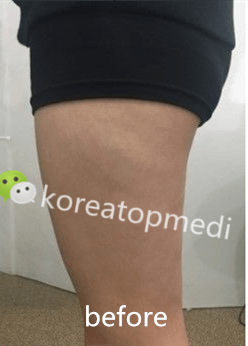 QQ截图20160719101157_副本 - 복사본.png