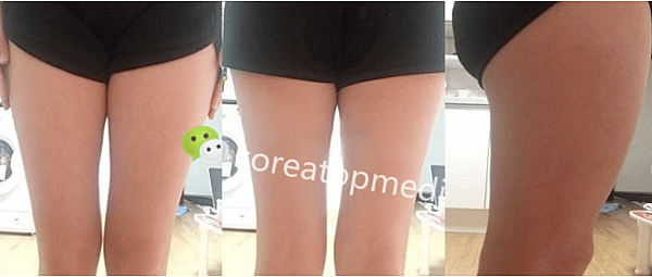 QQ截图20160719101212.png