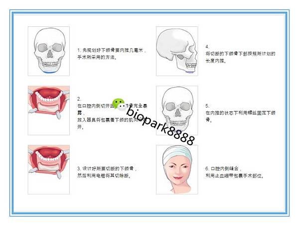 006p9jd5zy79bzrTyIY44%26;690.jpg