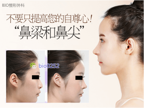 QQ截图20170330144350.png