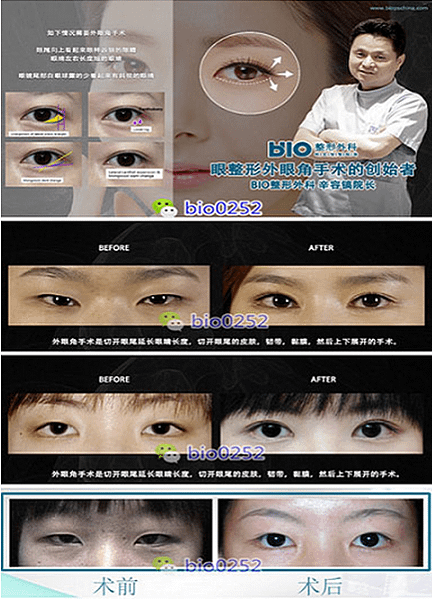 QQ截图20170405154243.png