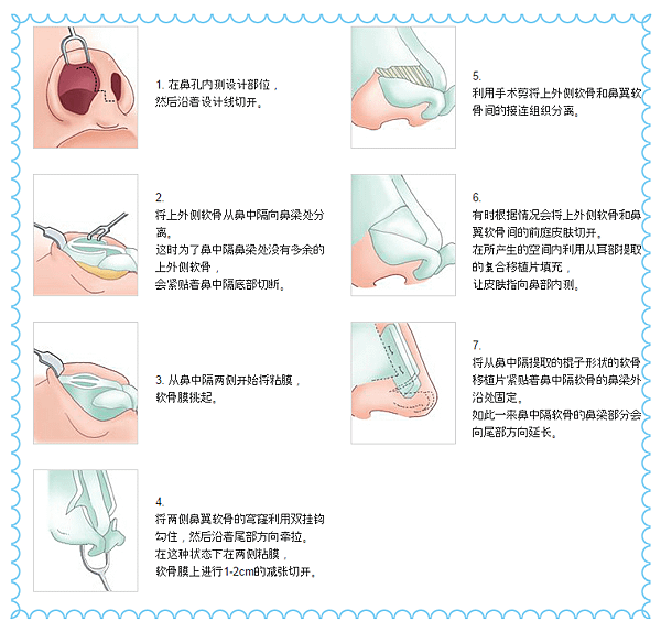 QQ截图20170410113415_副本.png