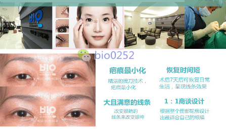 QQ截图20170410144339.png