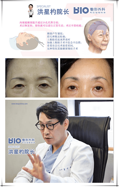QQ截图20170410153507.png